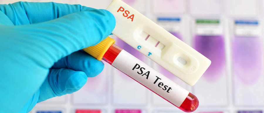 Normal PSA Level For Men's Prostate ProstaGenix