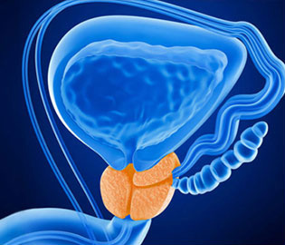 diagram of prostate